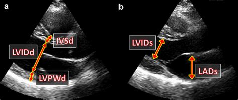 echo lv|lvidd echo meaning.